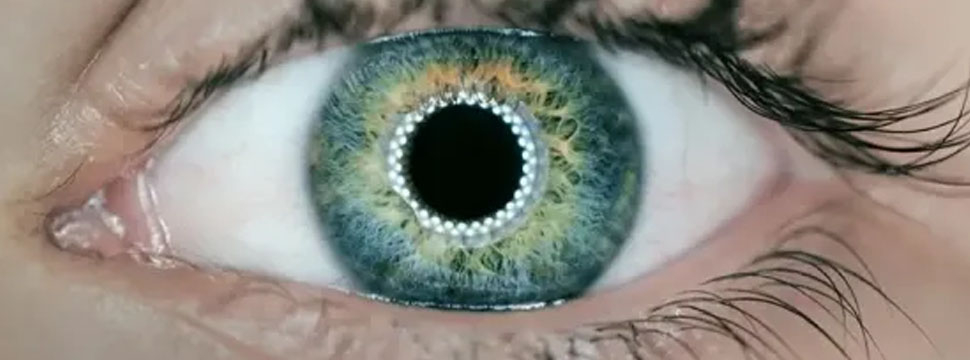 Напечатанная на принтере роговица вернула зрение слепому пациенту